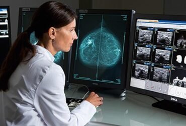 venta de monitores de diagnostico para radiografias